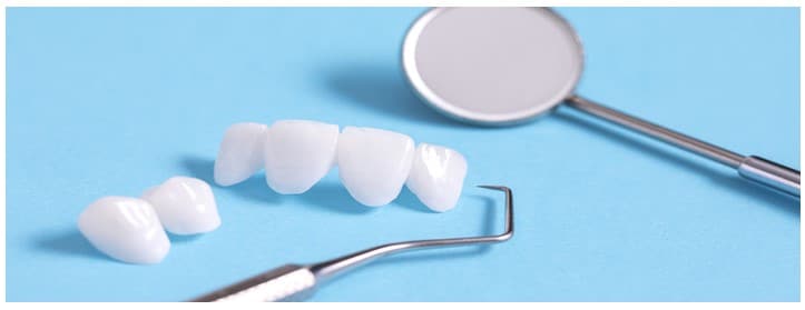 How to Take Care of Your Porcelain Veneers