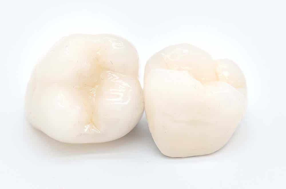 Reliable and durable zirconium crowns for the All-on-4 prosthesis
