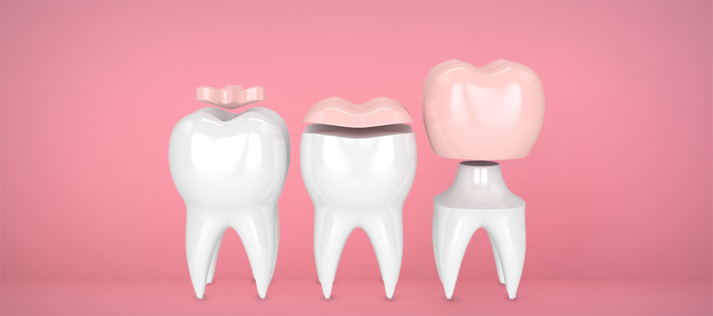 Dentures on healthy teeth