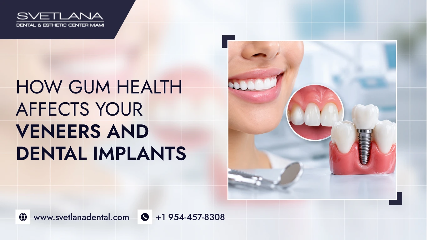 How Gum Health Affects Your Veneers and Dental Implants