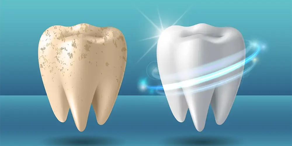 Teeth whitening at the molecular level