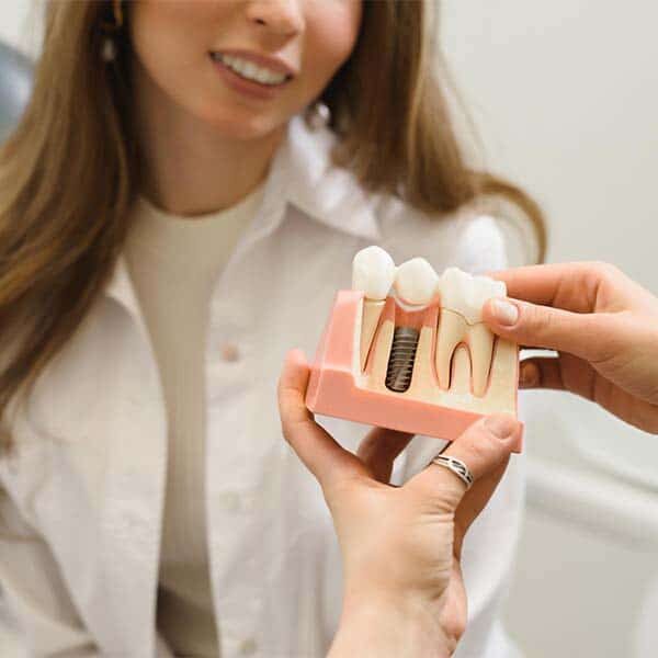 dental implants 1